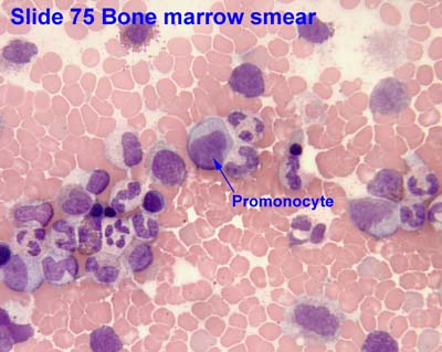 Promonocyte Wikipedia